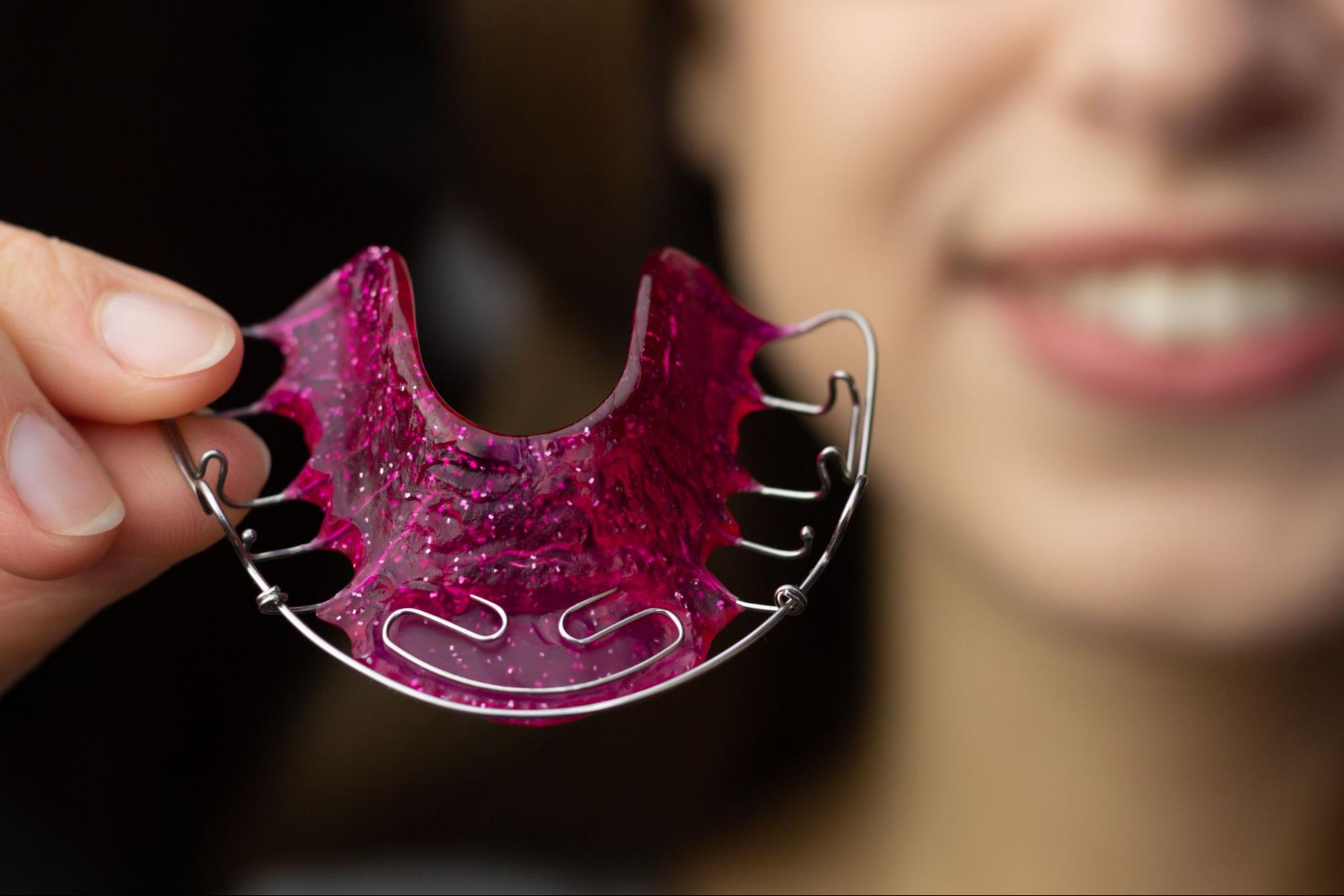 Everything You Need to Know About Retainers